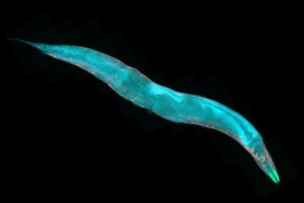 Researchers are using worms to figure out how humans can add years to their lives